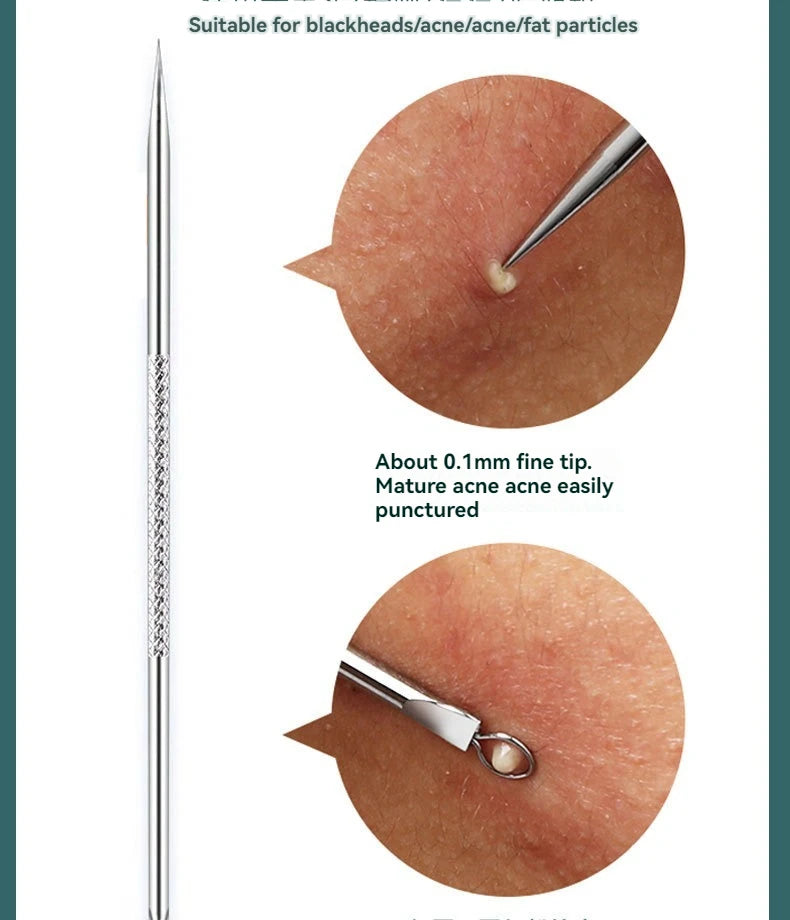 4Pcs/Set AcneTool Set