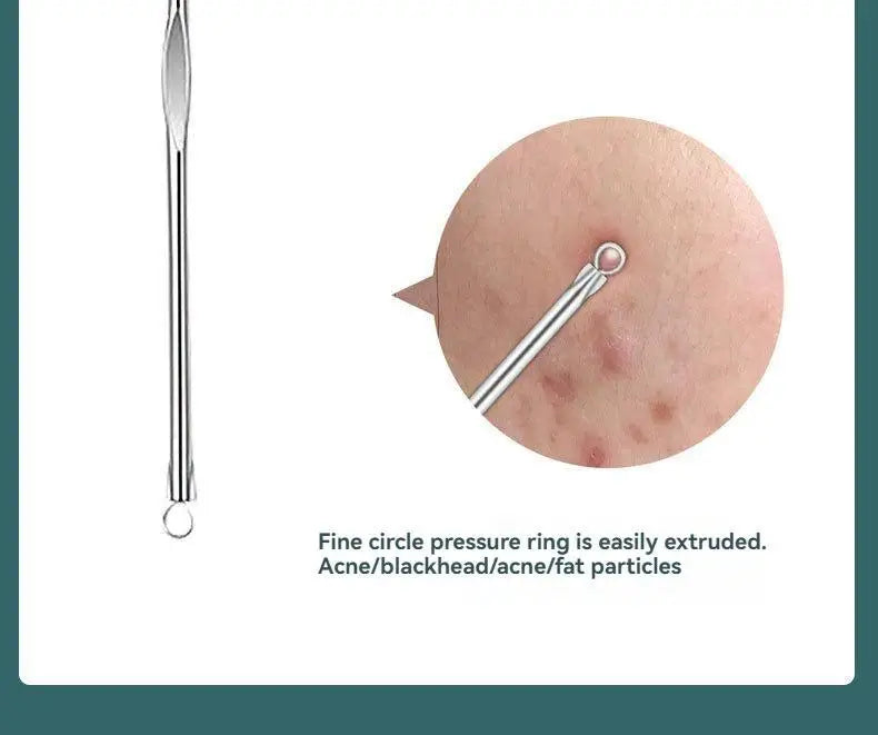 4Pcs/Set AcneTool Set