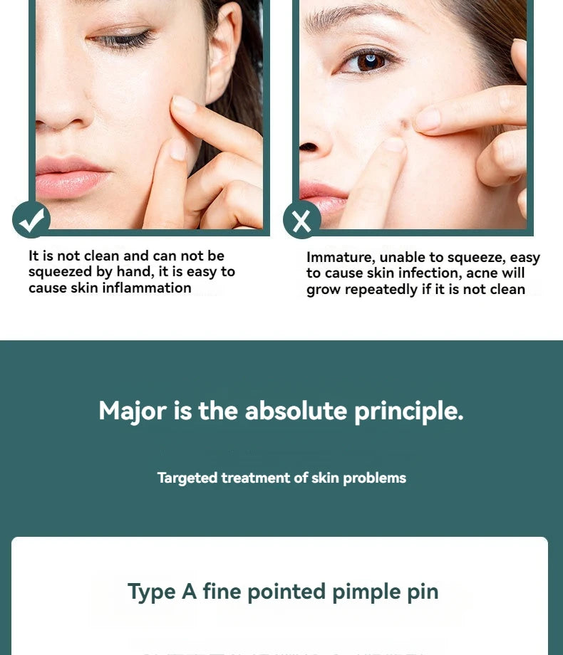 4Pcs/Set AcneTool Set