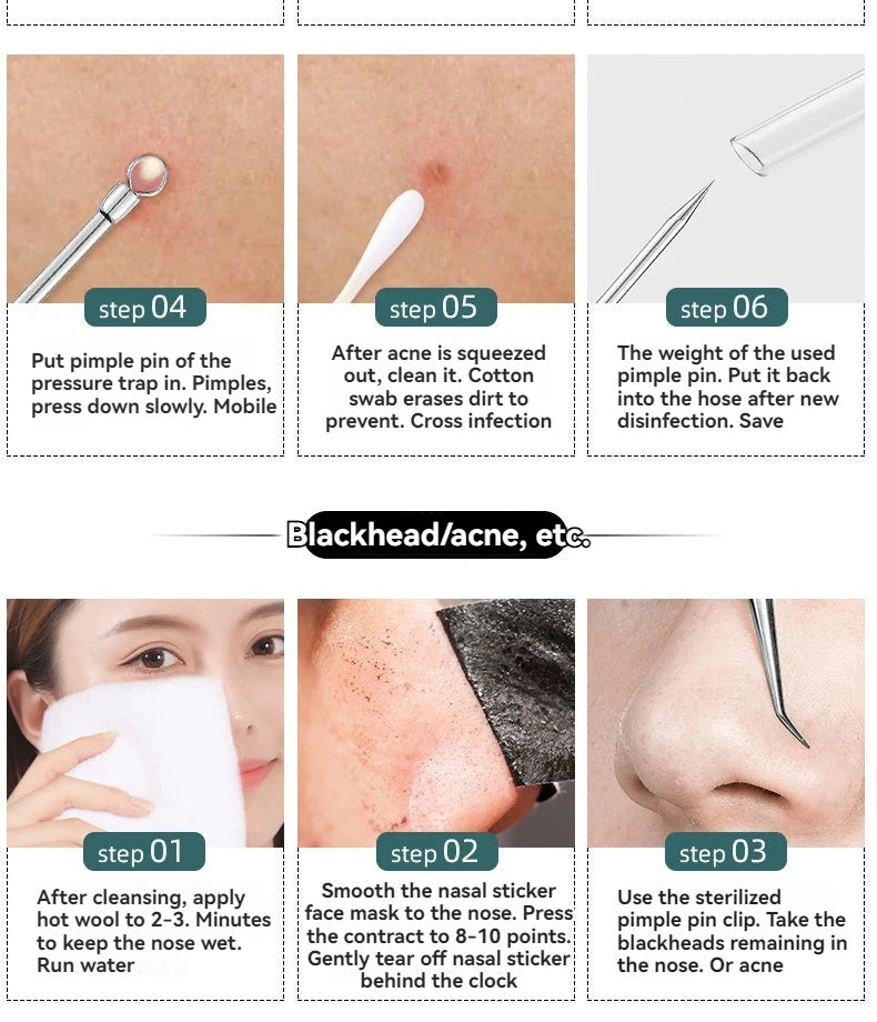 4Pcs/Set AcneTool Set